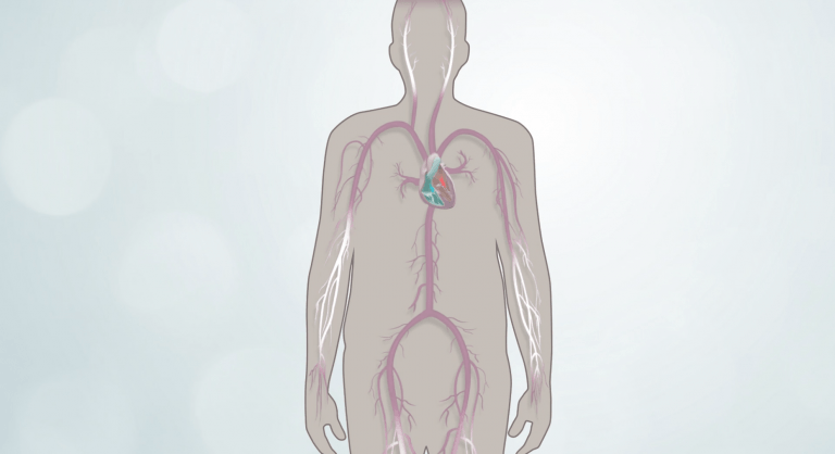Heart valve placement